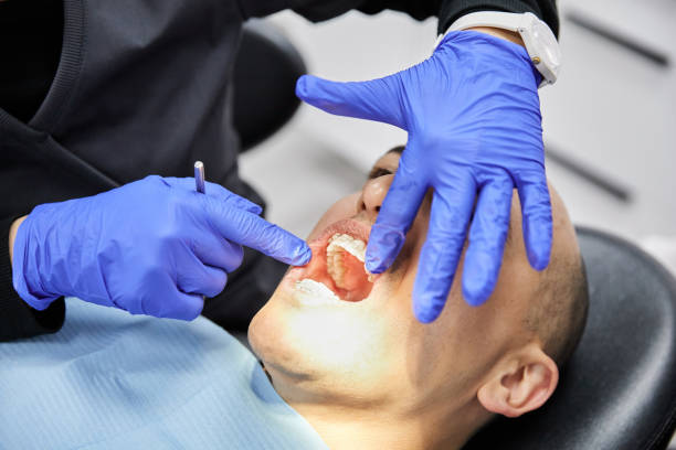 Best Emergency Wisdom Tooth Extraction in Hiram, GA